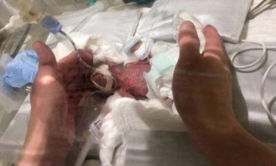 El bebé más pequeño del mundo es de Japón