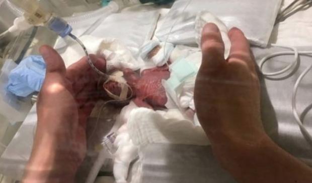 El bebé más pequeño del mundo es de Japón